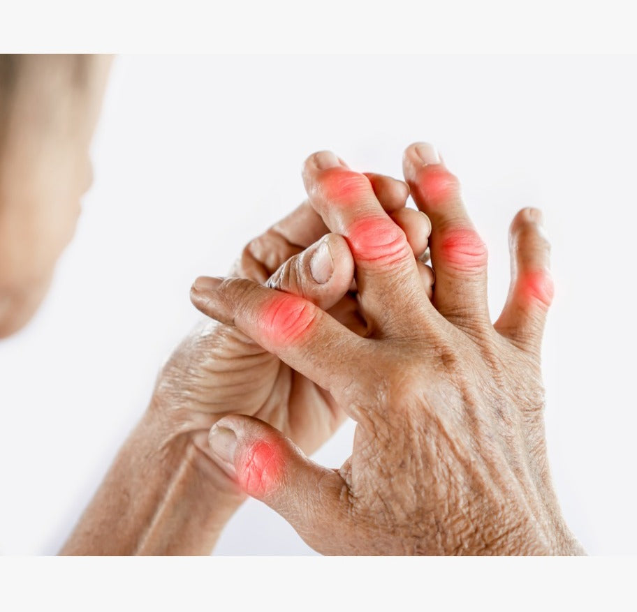 Arthroil - Ayurvedic Approach to Treat Rheumatoid Arthritis